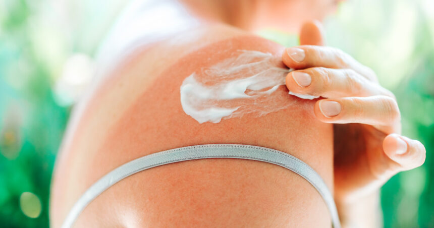 ce face o crema cu spf sa fie cu adevarat eficienta dermatologii explica cum poate contribui la reducerea riscului de cancer de piele 6a51c69603e77