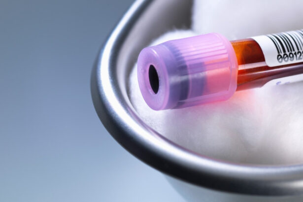 premiera medicala in sua un robot va putea recolta singur sange de la pacienti cum functioneaza noua tehnologie 6a8ab9db1080e