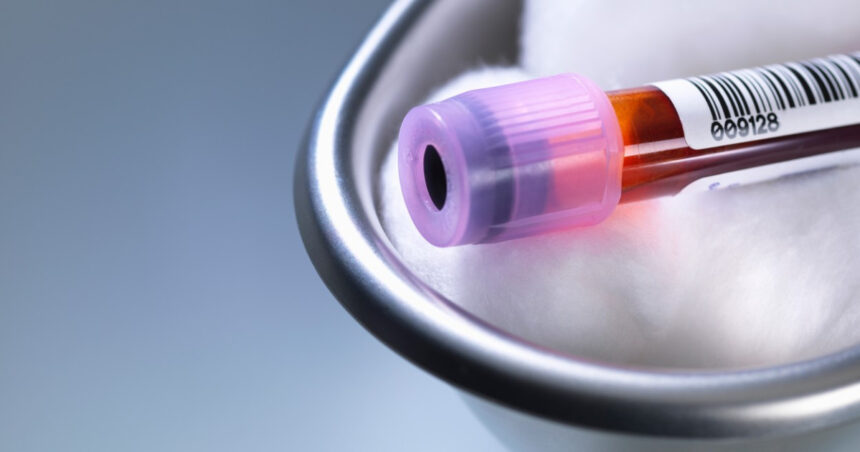 premiera medicala in sua un robot va putea recolta singur sange de la pacienti cum functioneaza noua tehnologie 6a8ab9db1080e