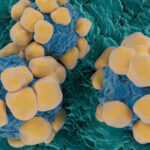 un ingredient activ din viagra ar putea limita raspandirea cancerului studiu 6a7186b172bf2