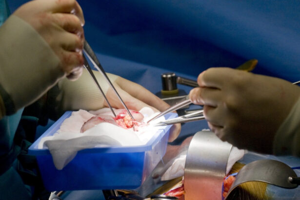 record medical un rinichi de porc transplantat a functionat in corpul unui pacient din sua timp de 271 de zile 6a9a9d758a41a