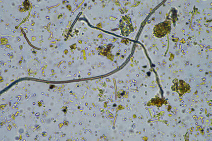 o ciuperca rara care ataca creierul se raspandeste in sua infectia poate ucide pana la 70 dintre pacienti 6ad37bc04e3f5