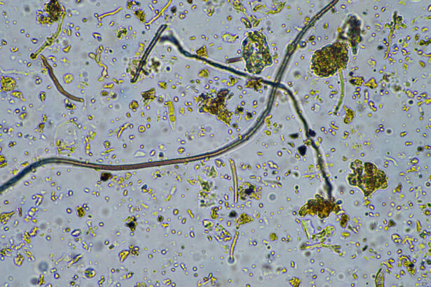 o ciuperca rara care ataca creierul se raspandeste in sua infectia poate ucide pana la 70 dintre pacienti 6ad37bc04e3f5