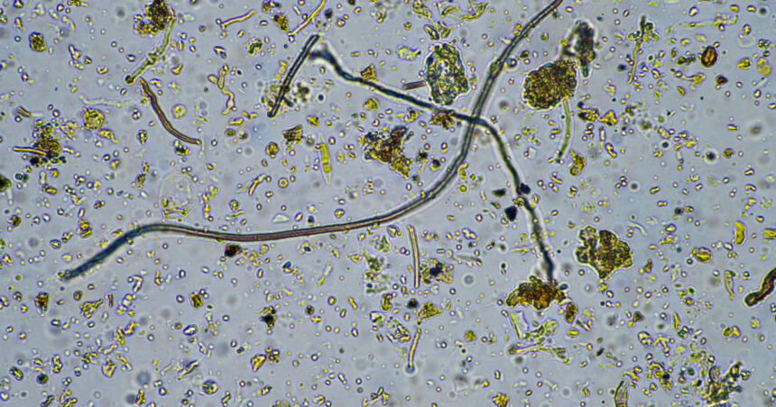 o ciuperca rara care ataca creierul se raspandeste in sua infectia poate ucide pana la 70 dintre pacienti 6ad37bc04e3f5